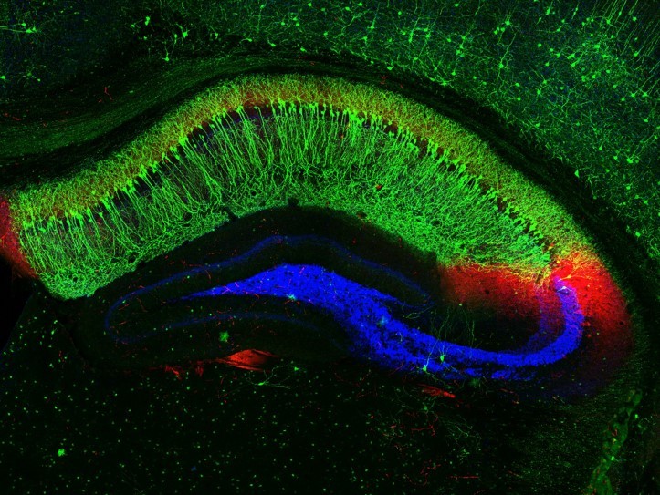 Cognitive neuroscientist studies neural networks to