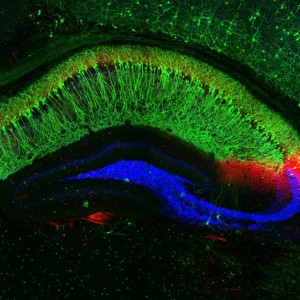 Colorful image of hippocampus in the brain
