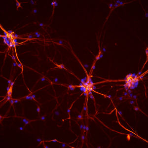Neurons from a mouse spinal cord
