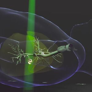Radiation illustration