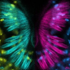 Johnston&#039;s organ